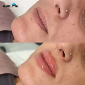 Two images depicting the before and after results of a lip blush tattoo procedure.