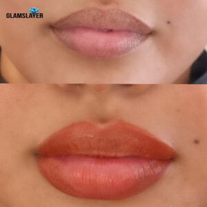 A pair of lips before and after lip neutralization procedure.