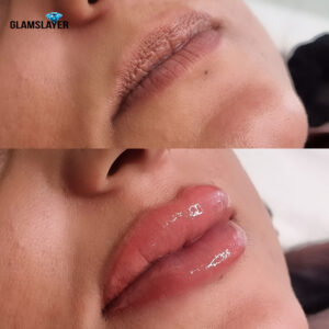 Two images showing a before and after comparison of a lip blush tattoo procedure.